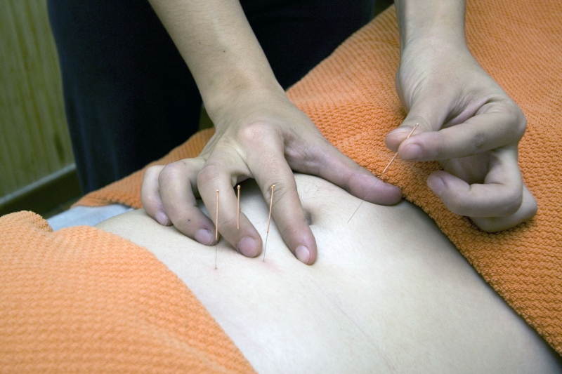 osteopathe-SEILLANS-min_acupuncture-4175625